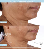 Nuface Trinity+ Starter Kit facial toning device with attachments and serums, imported from the UK