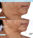 Nuface Trinity+ Starter Kit facial toning device with attachments and serums, imported from the UK