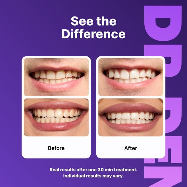 DR.DENT purple whitening strips 42 strips, UK version