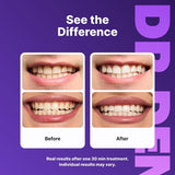 DR.DENT purple whitening strips 42 strips, UK version