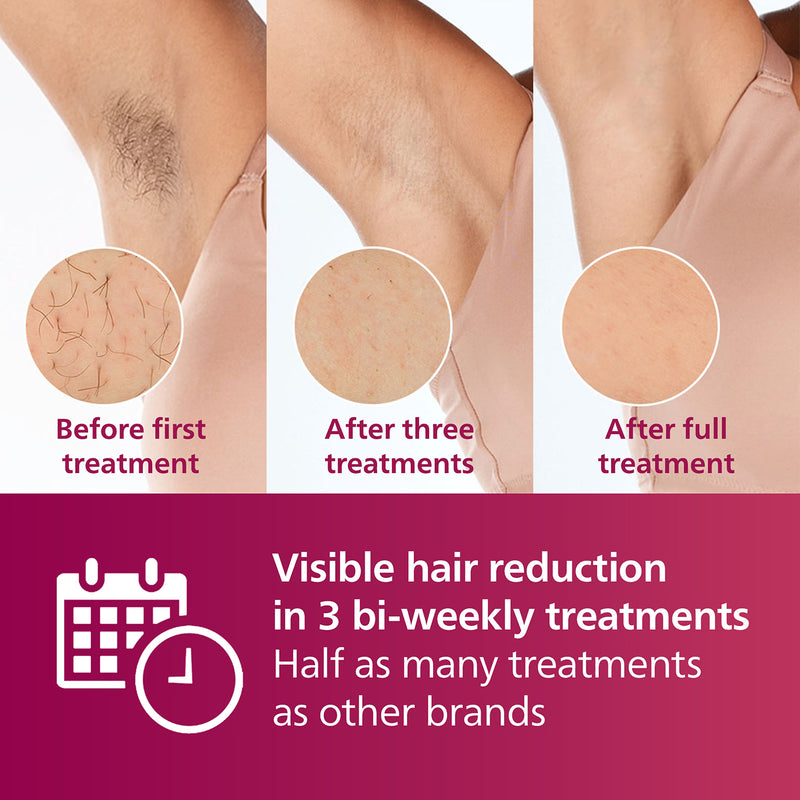 Philips Lumea 7000 IPL hair removal device (British brand)