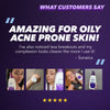 Acnecide Purifide face wash with zinc 235ml (British brand)
