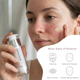 FrezyDerm Tinted Cream SPF30 30ml (British brand)