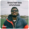 Sons Minoxidil hair regrowth solution 5% (British brand)
