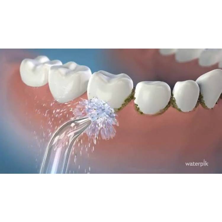Waterpik Classic Jet Tip Attachment, UK version