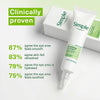 Simple Kind To Eyes Soothing Eye Balm 15ml (British brand)