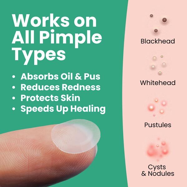 LLS hydrocolloid spot patches 60pk, imported from the UK