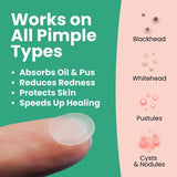 LLS hydrocolloid spot patches 60pk, imported from the UK