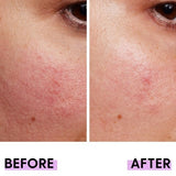 Me+ PHA Exfoliating Toner 200ml bottle, imported from the UK