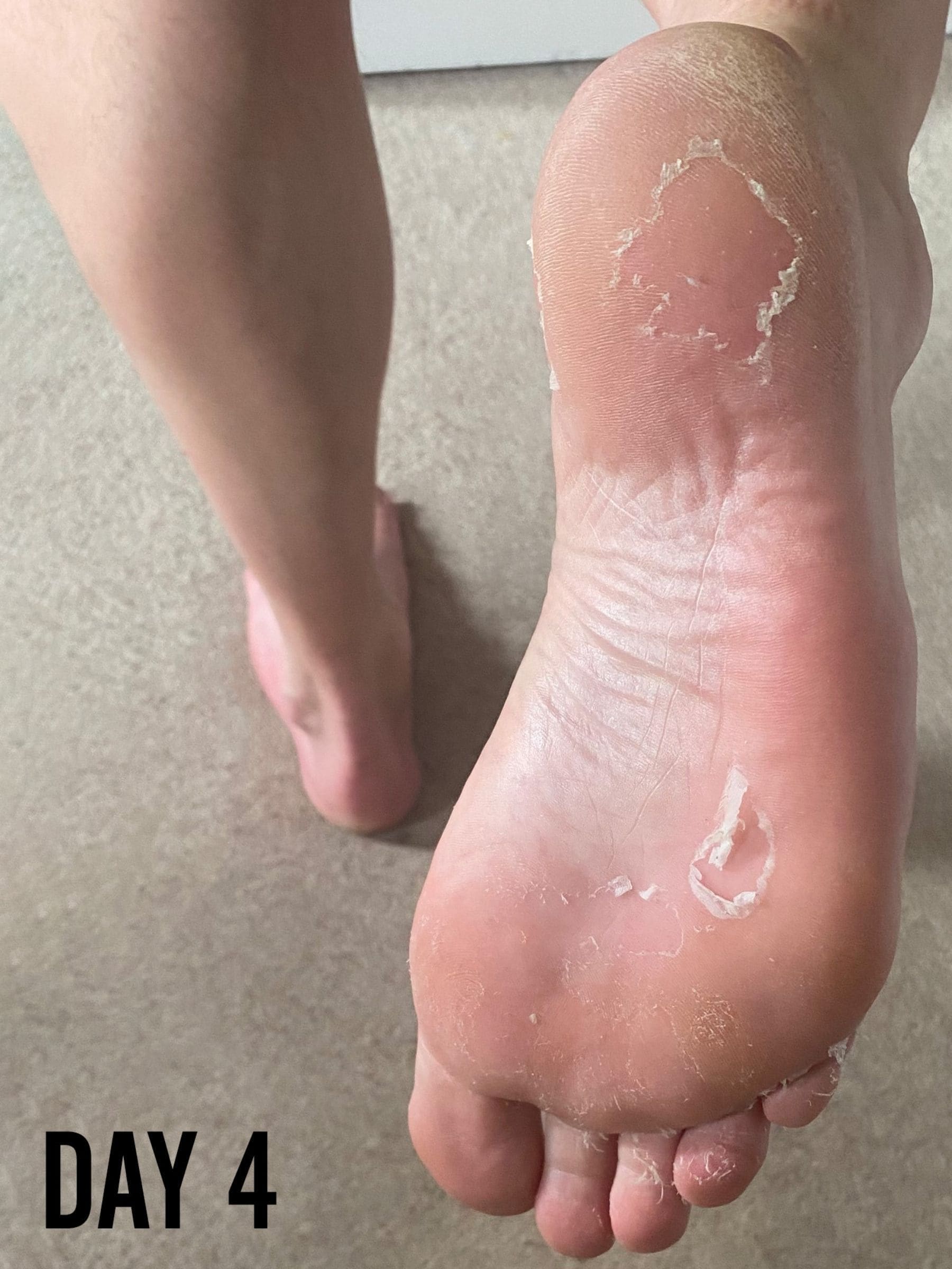 BARBER PRO foot peel bootie - British product
