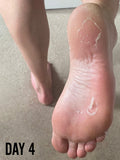 BARBER PRO foot peel bootie - British product