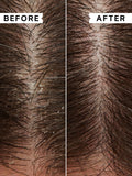 Philip Kingsley Flaky/Itchy Scalp Anti-Dandruff Conditioner 75ml