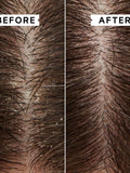Philip Kingsley Flaky/Itchy Scalp Anti-Dandruff Conditioner 1000ml