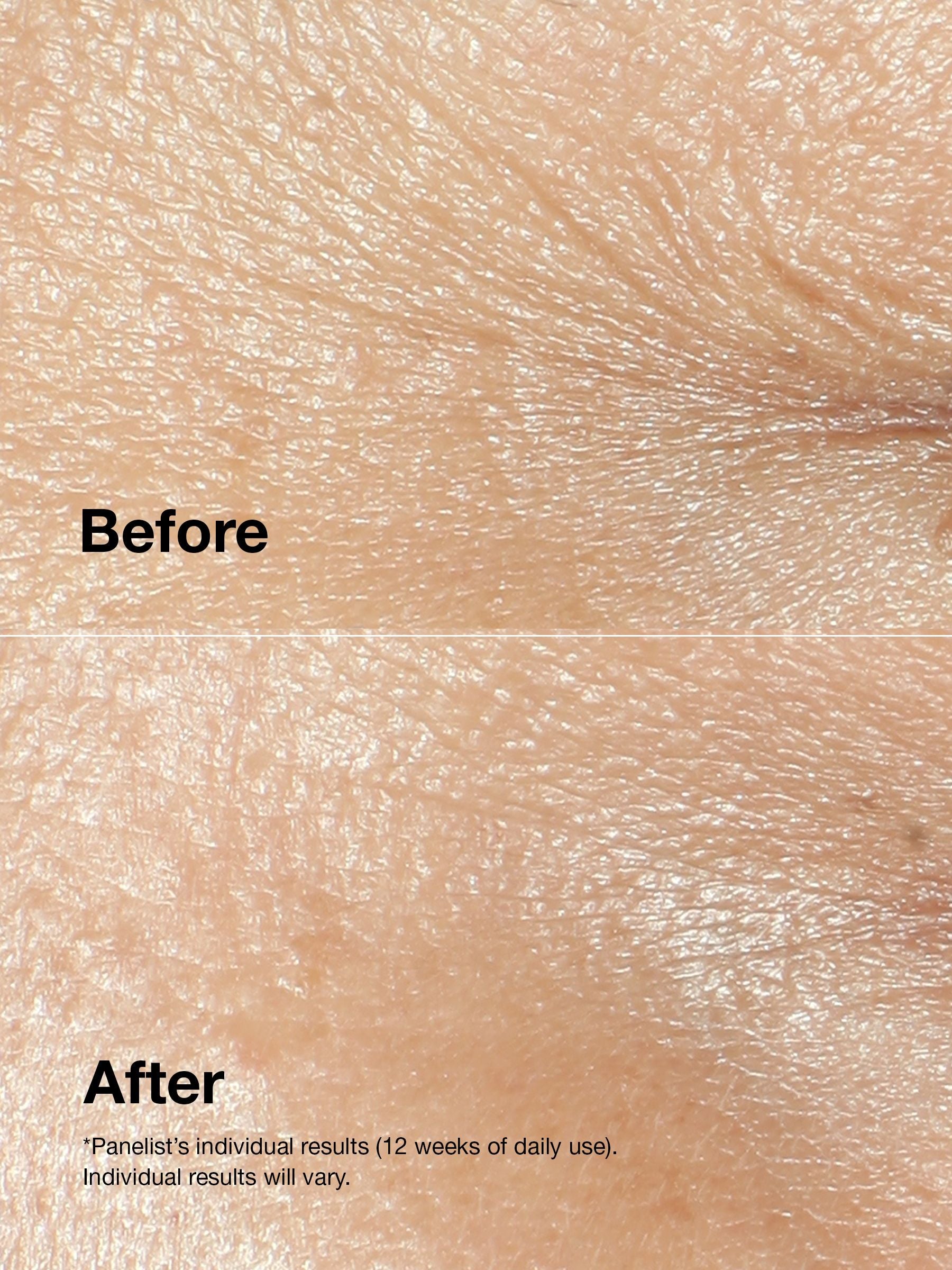 Clinique Smart Repair Wrinkle Correcting Cream 50ml - British product