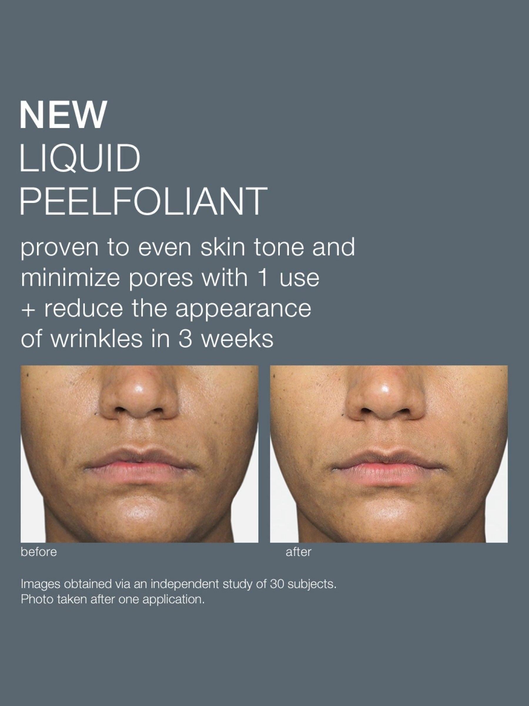 Dermalogica Liquid Peelfoliant 59ml - British product