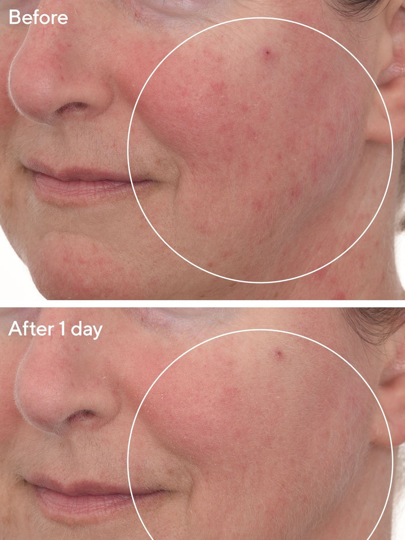 Murad Barrier Repair Mask 80ml, imported from the UK
