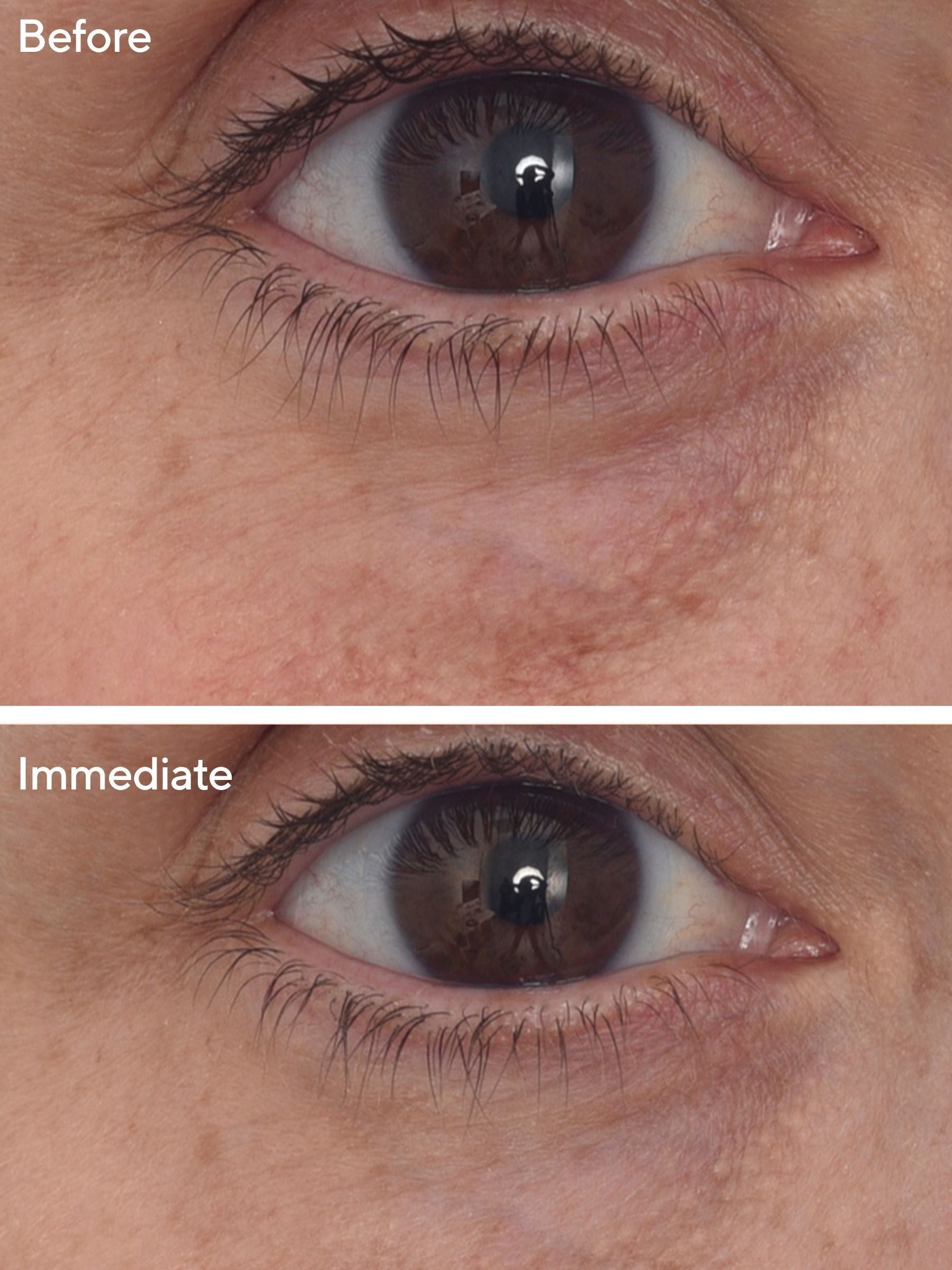 Murad Targeted Eye Depuffer eye treatment 15ml, imported from the UK