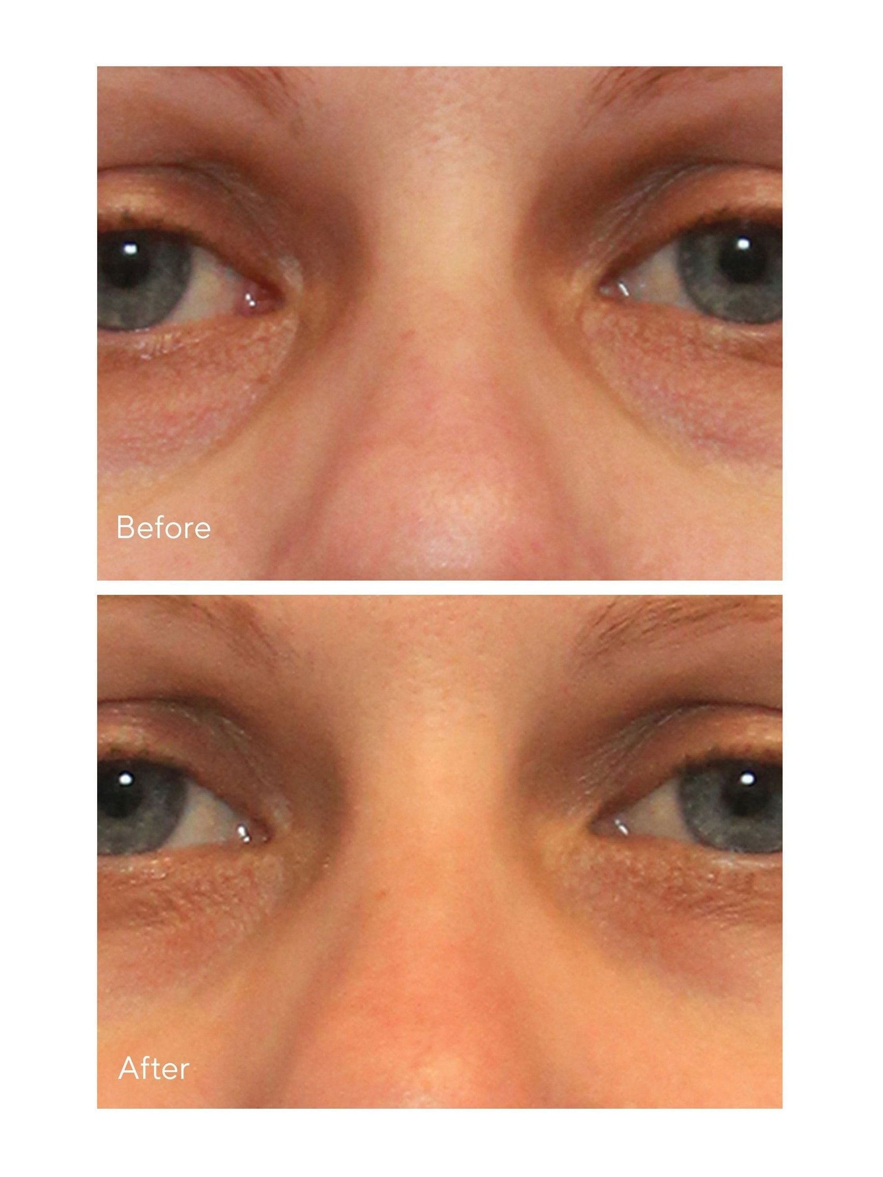 Murad Vita-C Eyes Dark Circle Corrector Serum 15ml, imported from the UK