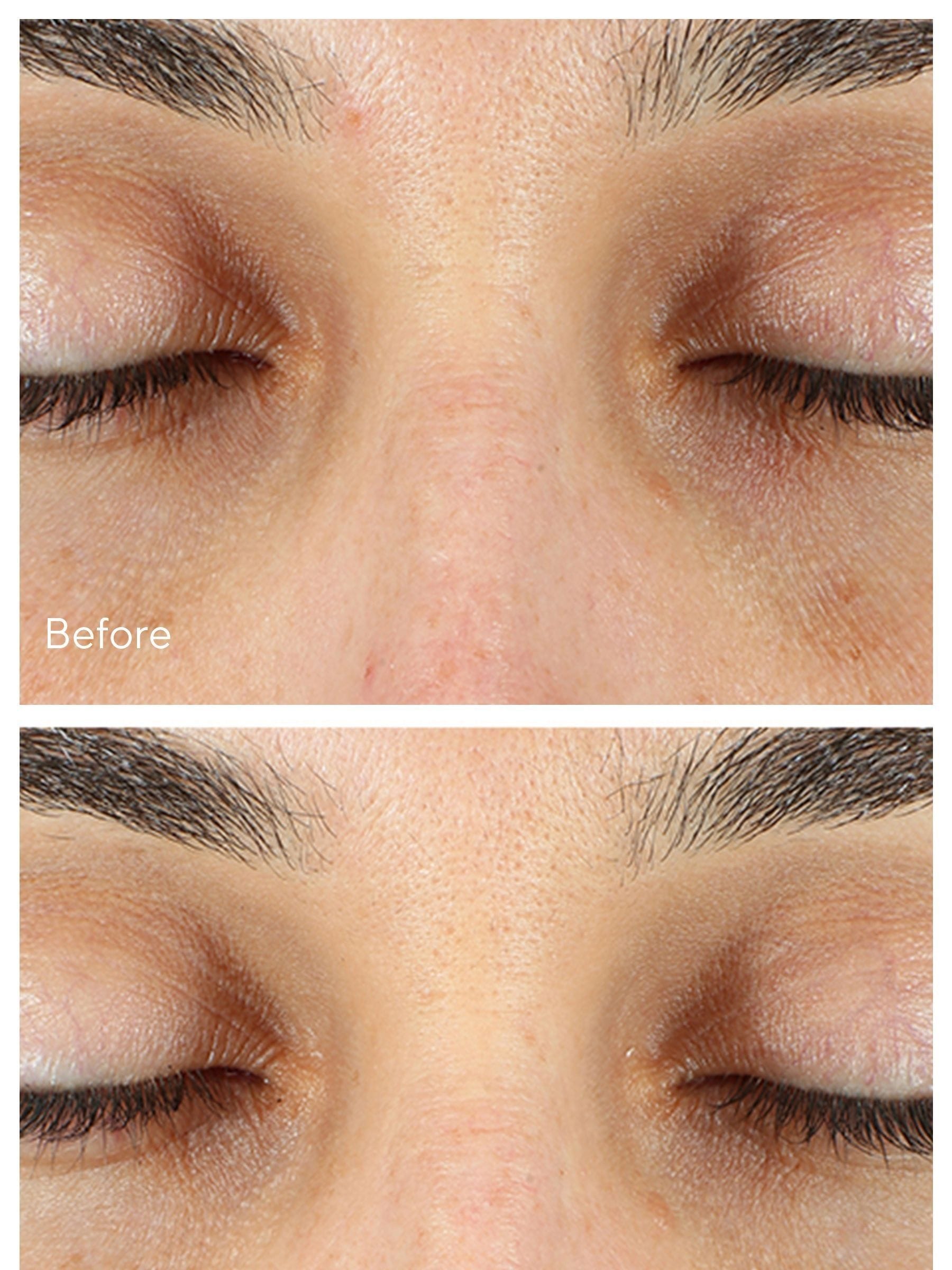 Murad Vita-C Eyes Dark Circle Corrector Serum 15ml, imported from the UK