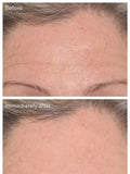 Murad targeted wrinkle corrector 15ml, imported from the UK