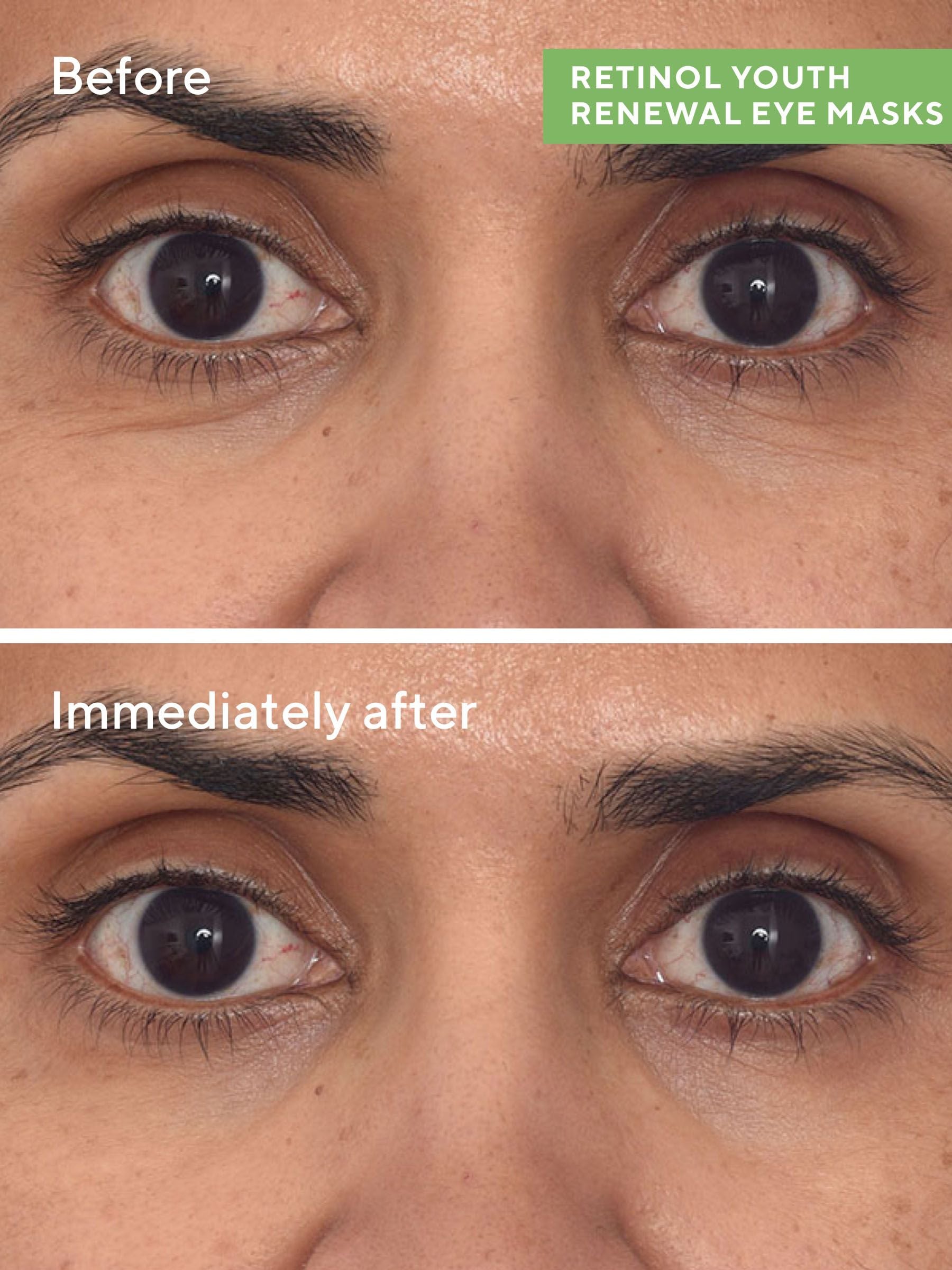 Murad retinol eye mask Youth Renewal, imported from the UK