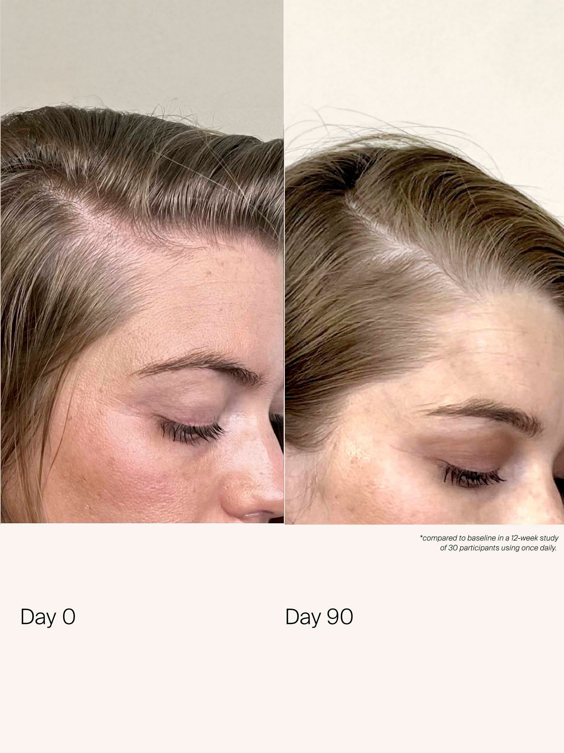 Living Proof Scalp Care Density Serum 50ml, UK version