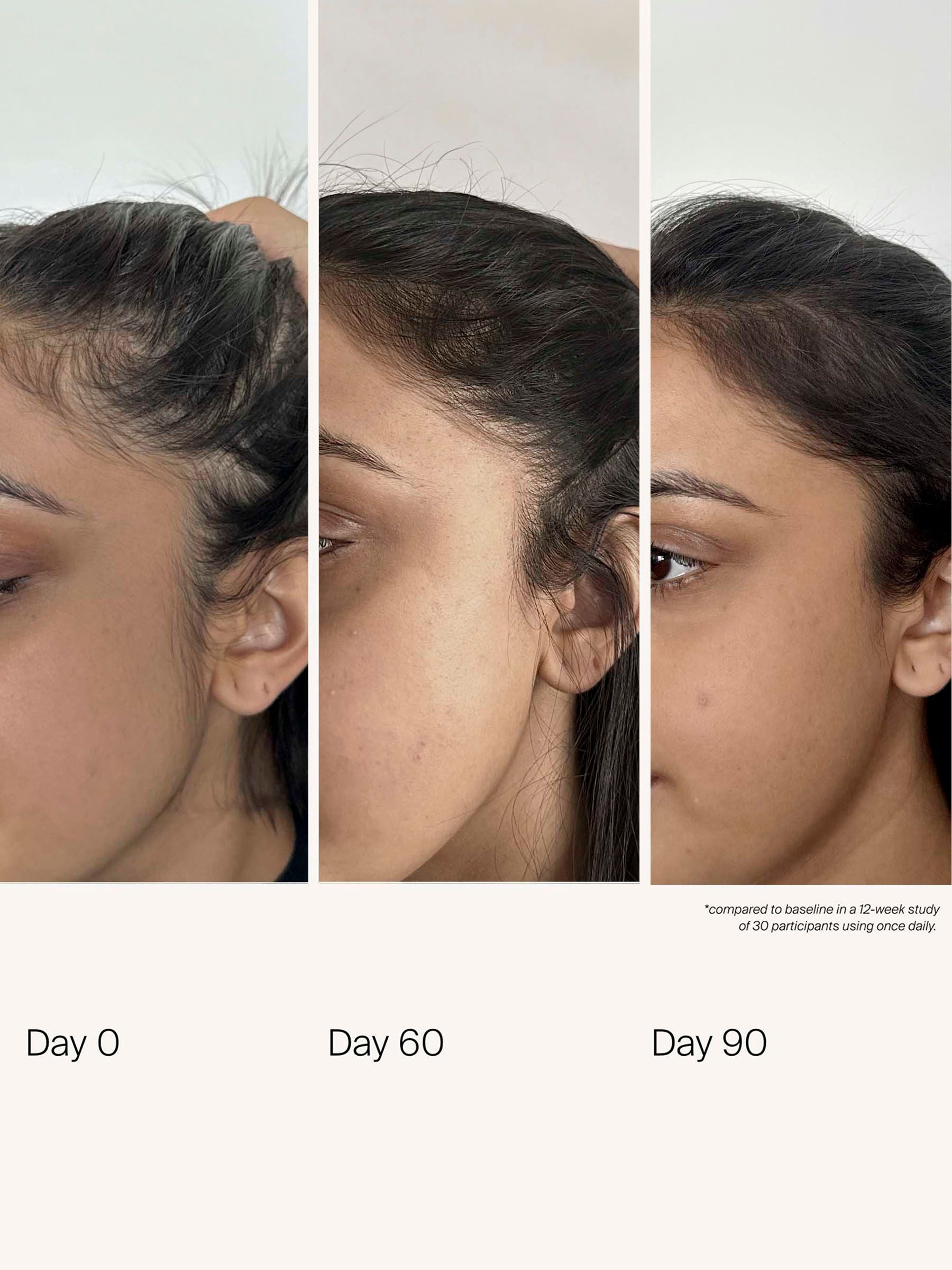 Living Proof Scalp Care Density Serum 50ml, UK version