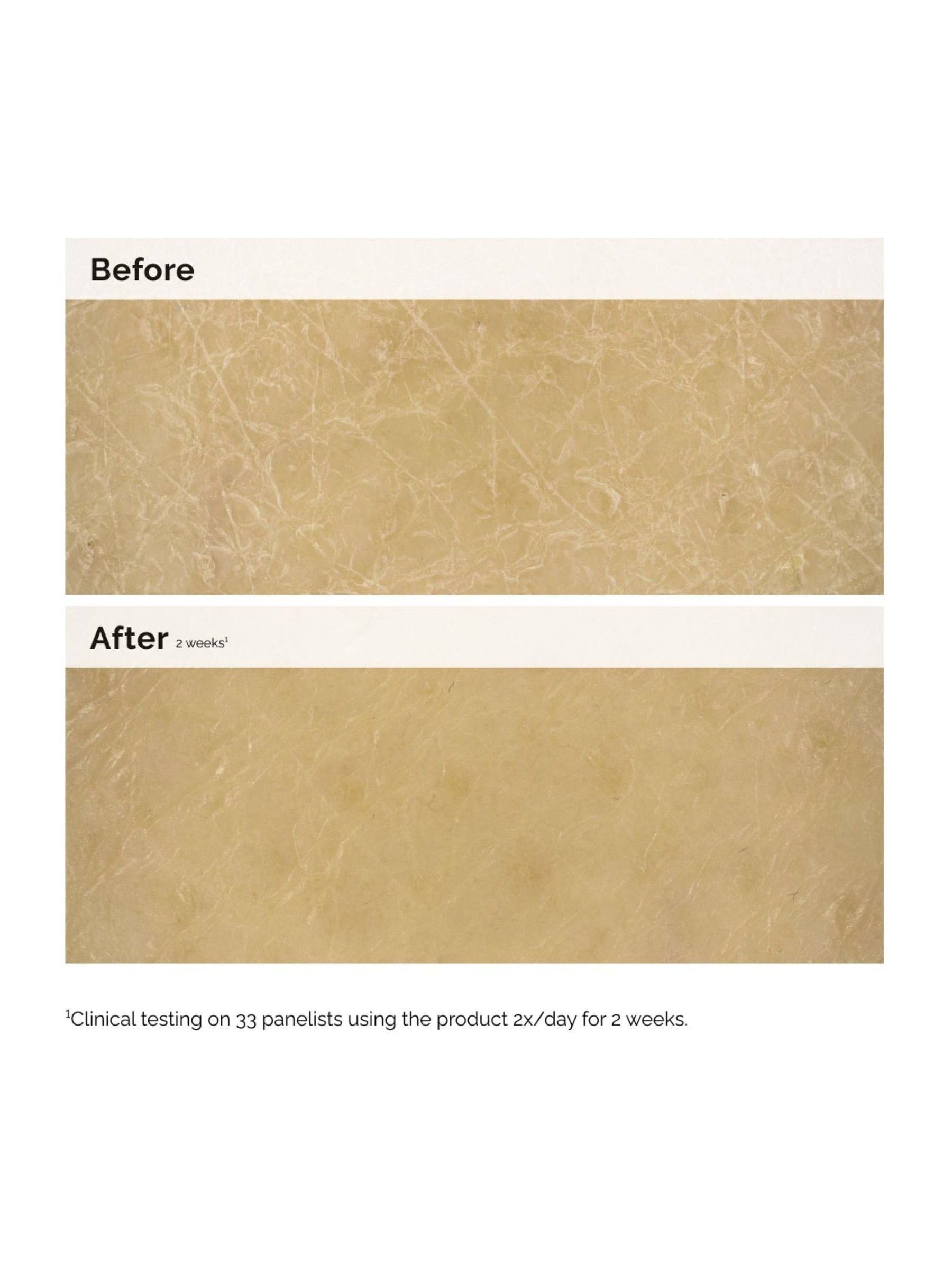 The Ordinary Natural Moisturizing Factors + Inulin Moisturising Body Lotion