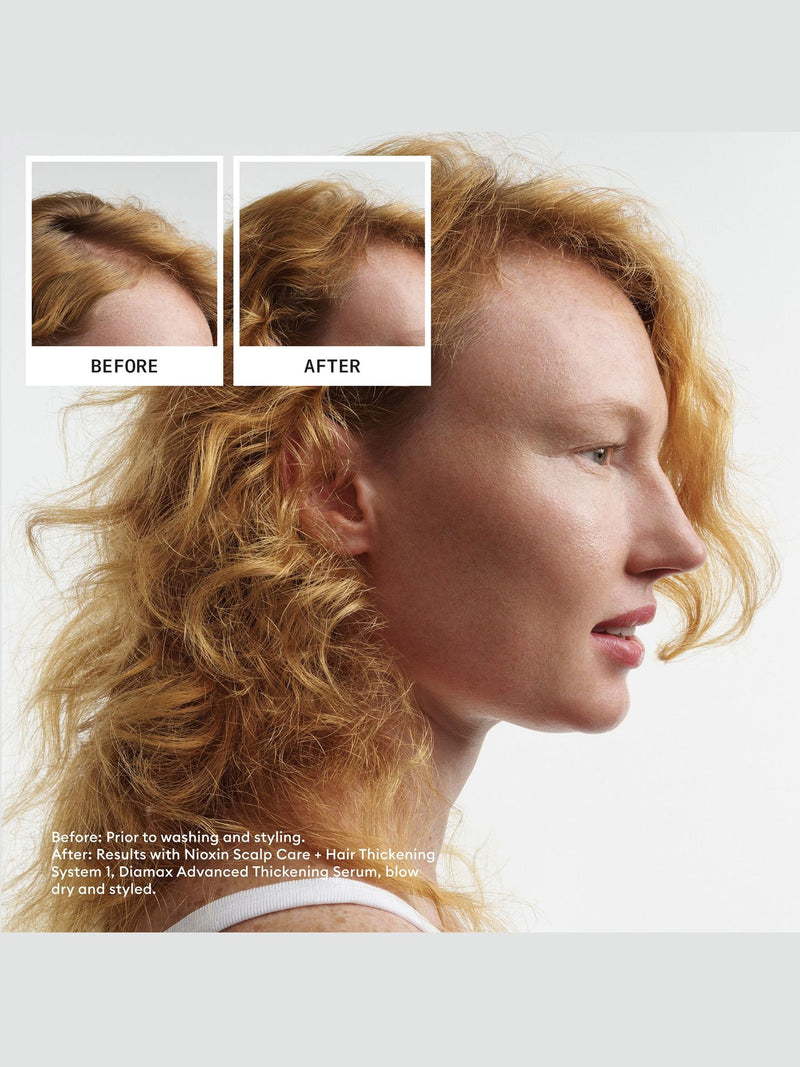Nioxin System 1 Loyalty Kit for thinning hair, imported from the UK