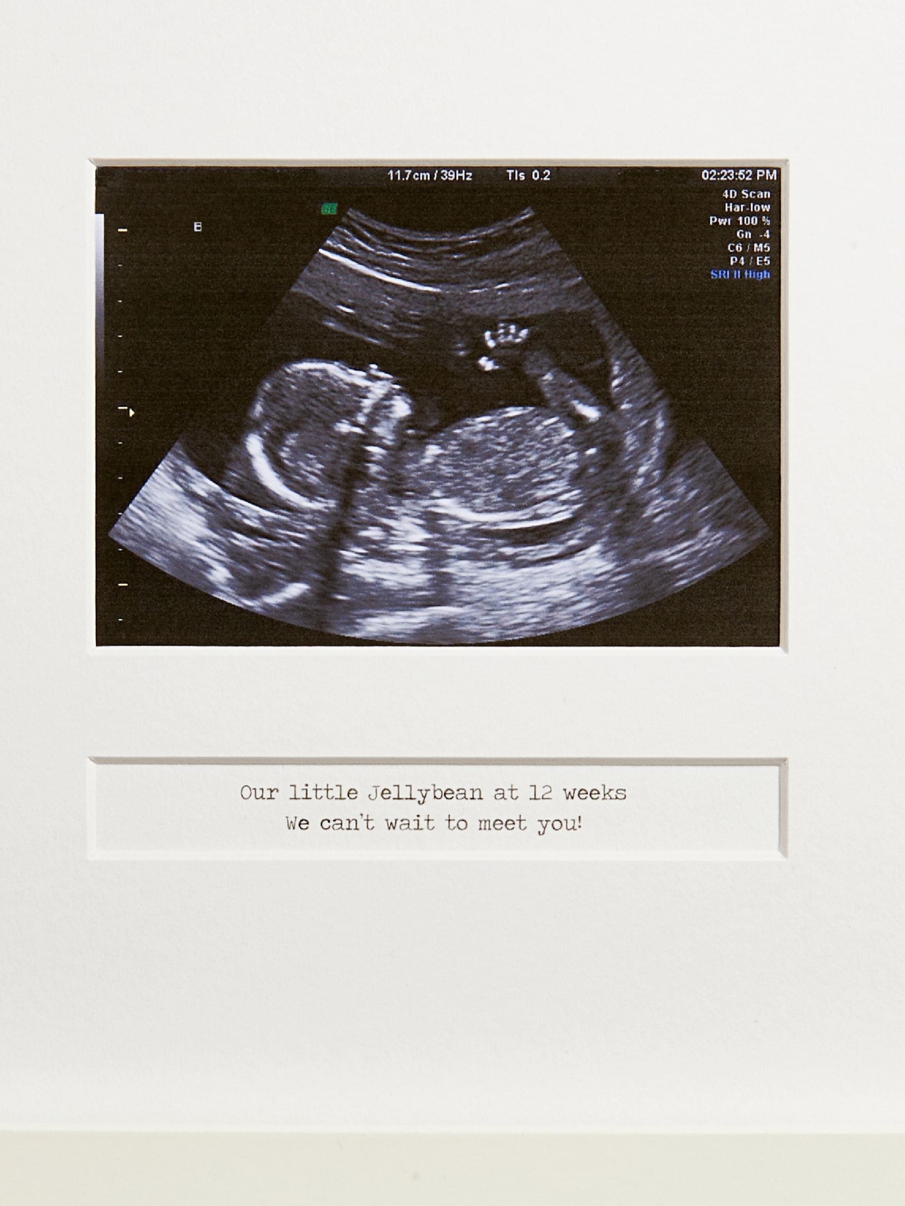 Posh Totty Designs Personalised My First Scan photo frame 25cm x 25cm, imported from the UK