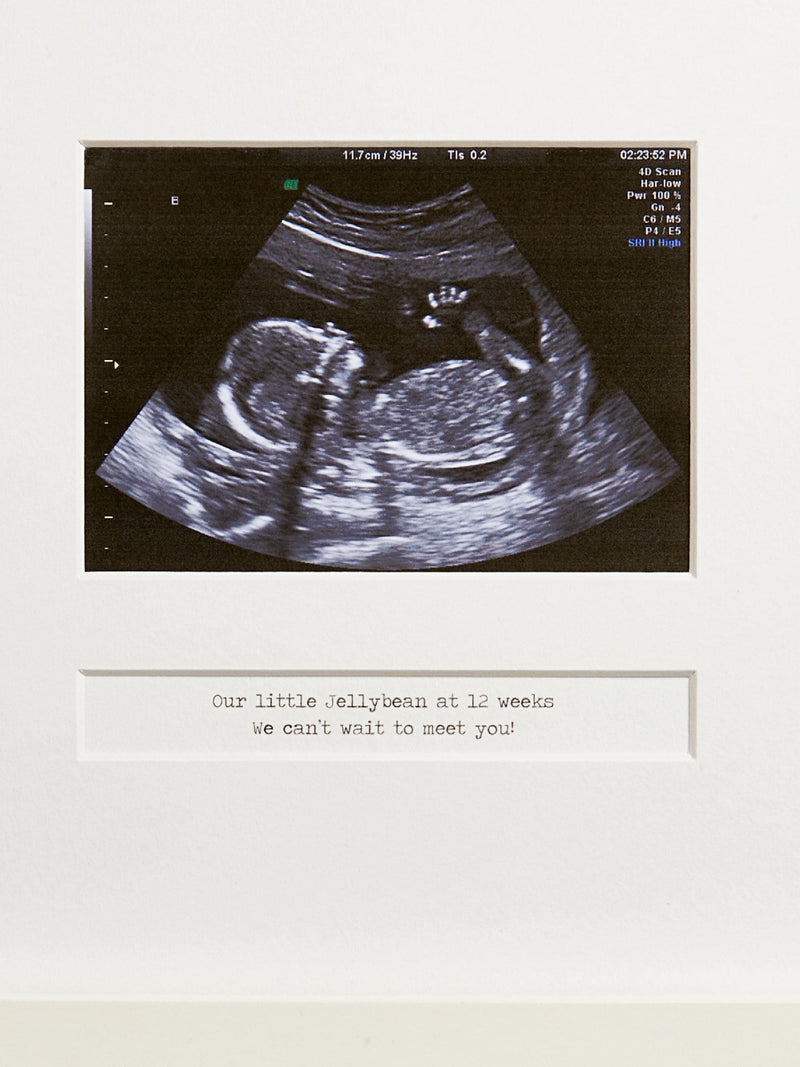 Posh Totty Designs Personalised My First Scan photo frame 25cm x 25cm, imported from the UK