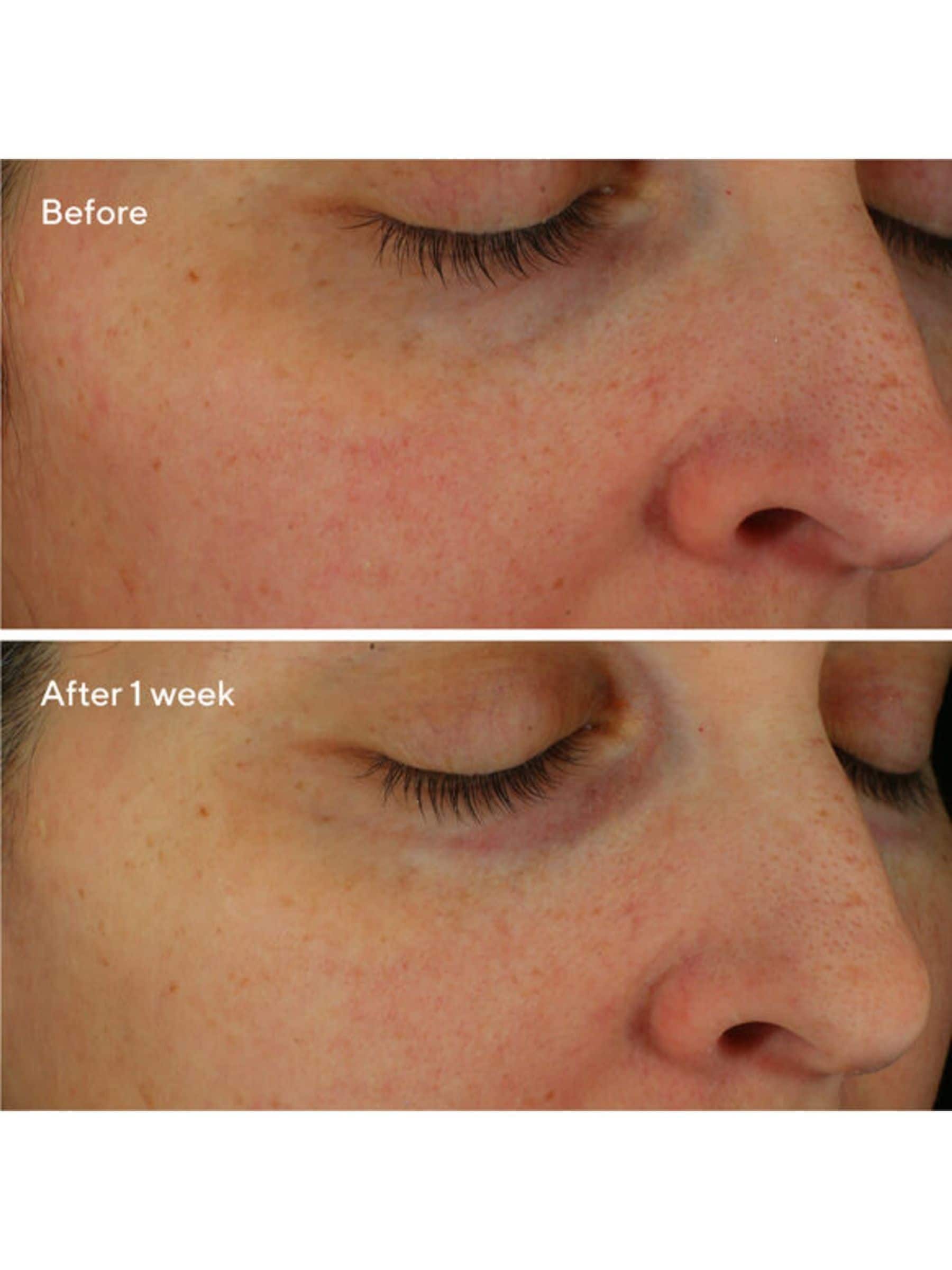 Murad Restorative HydroHyaluronic hydrating cream, imported from the UK