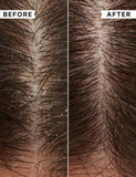 Philip Kingsley flaky itchy scalp treatment kit with mask shampoo and toner - British product