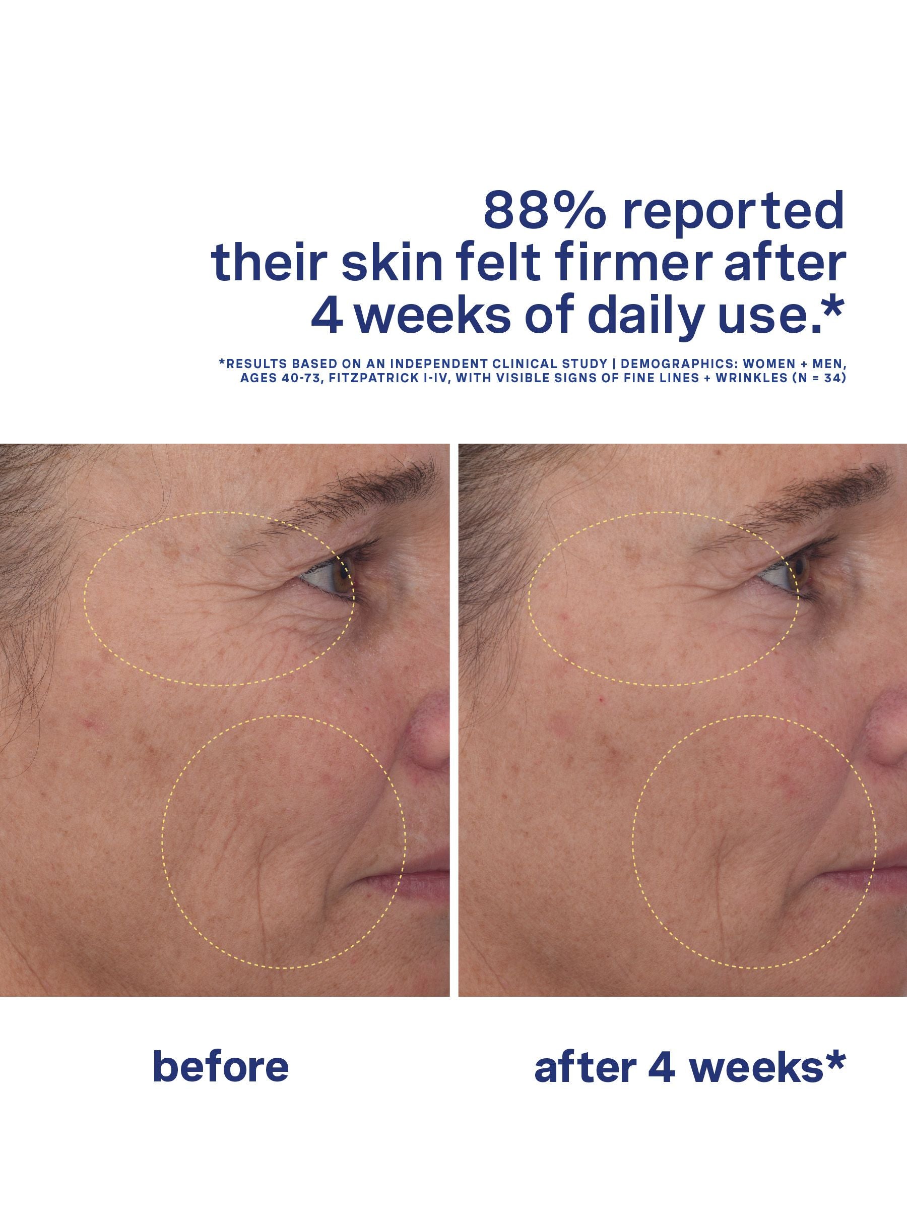 Kate Somerville Retinal+HA serum 30ml (British brand)