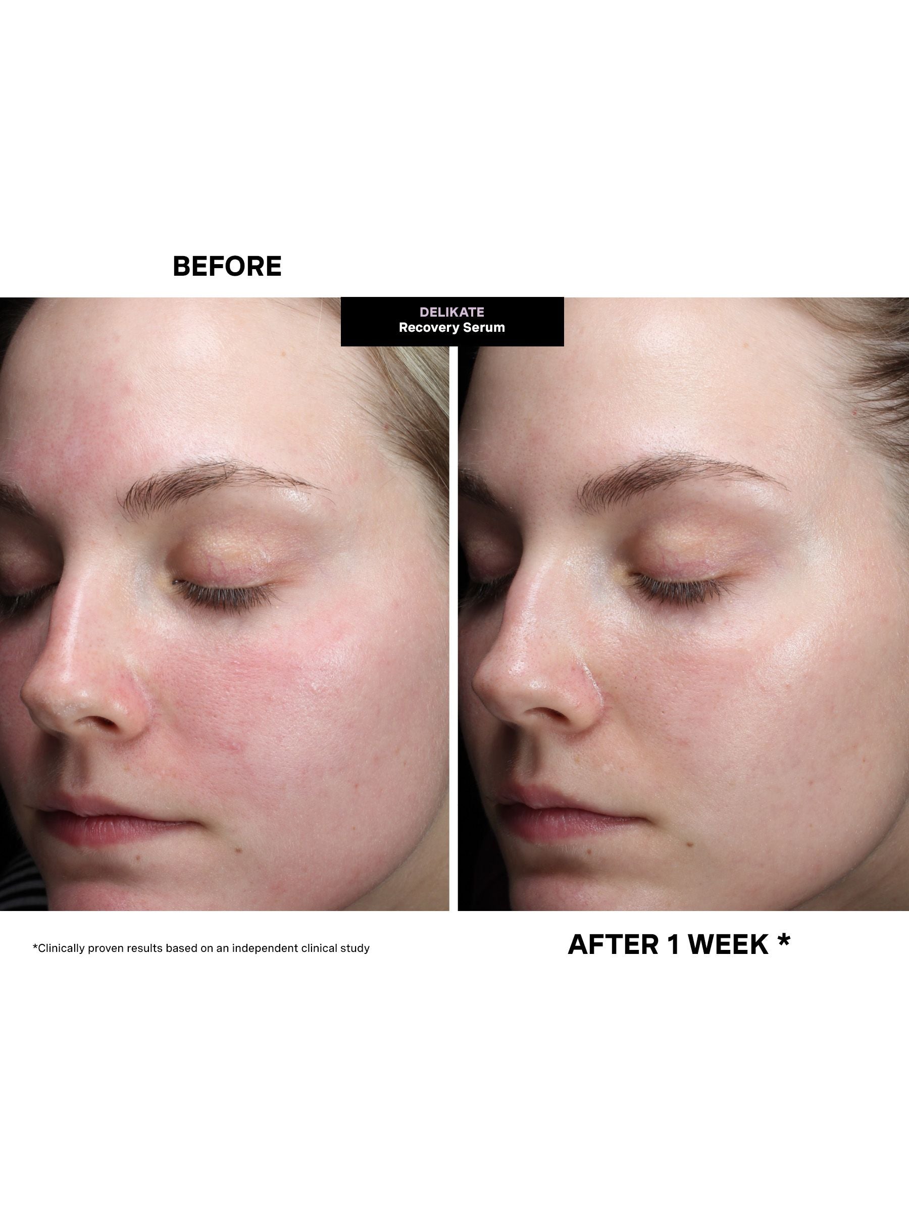 Kate Somerville DeliKate Recovery Serum 30 ml - British product