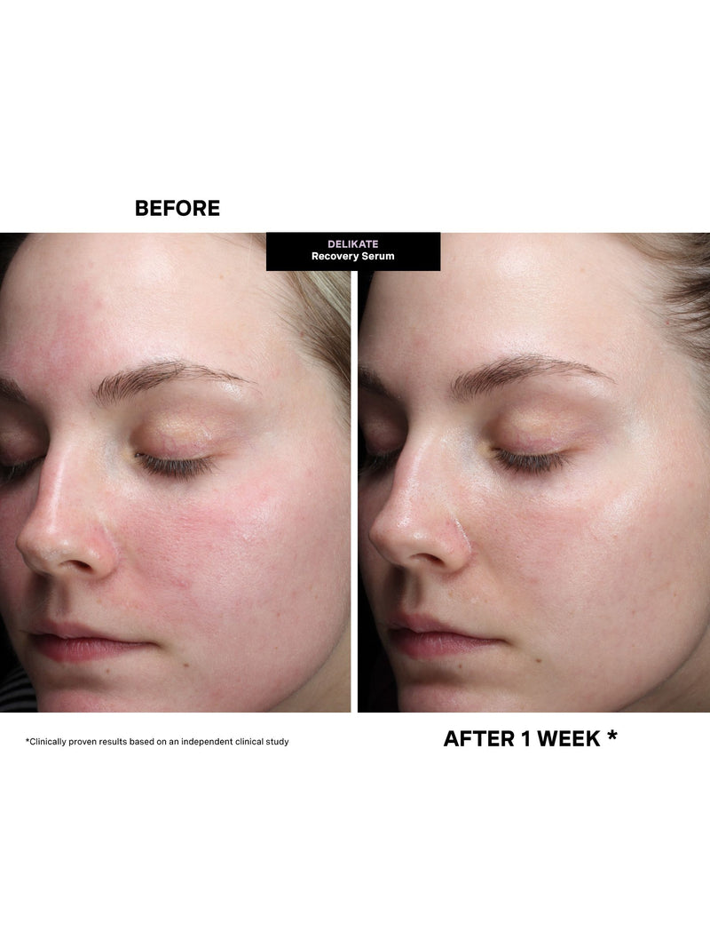 Kate Somerville DeliKate Recovery Serum 30 ml - British product