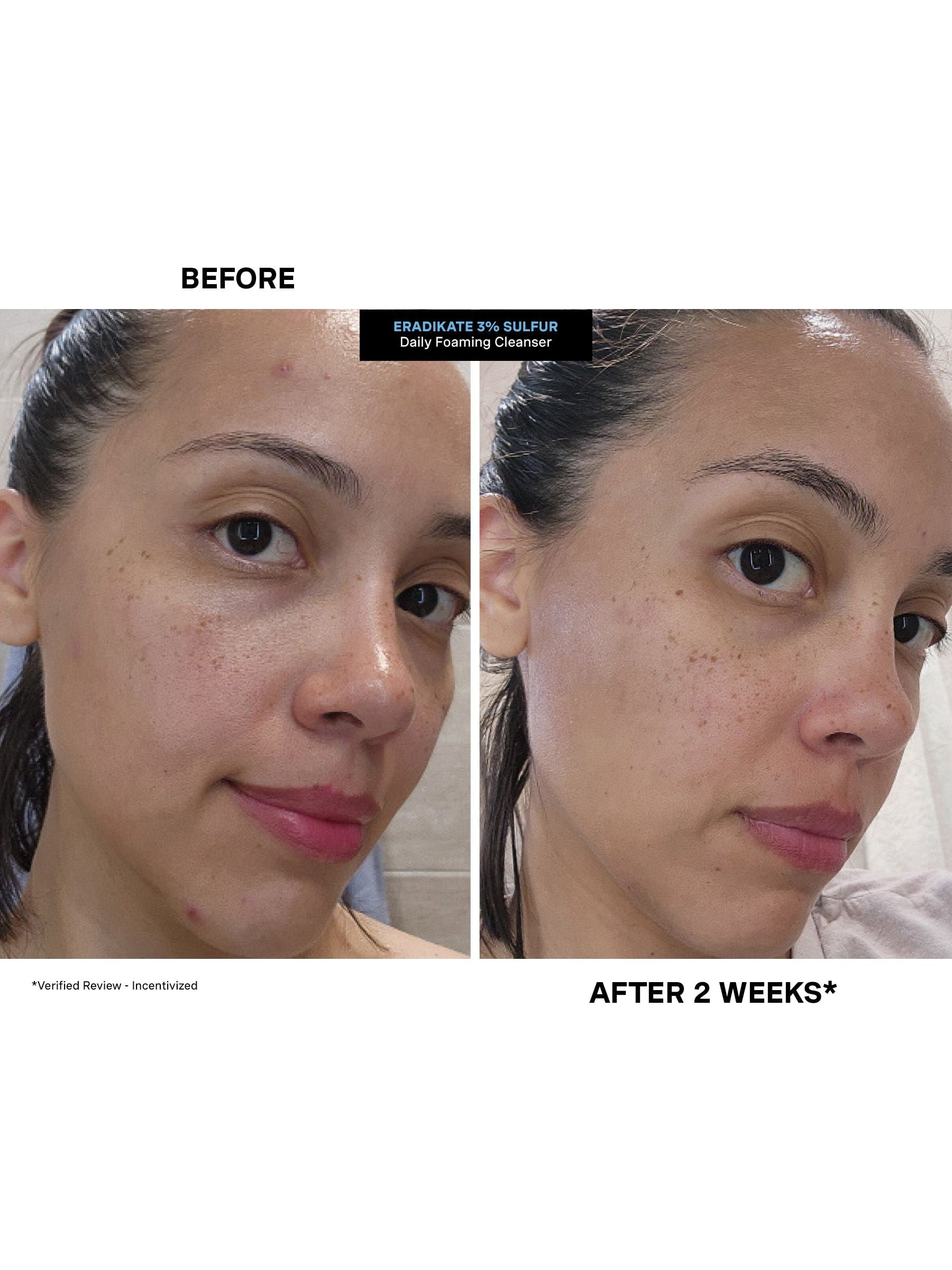 Kate Somerville EradiKate Daily Foaming Cleanser 120ml (British brand)