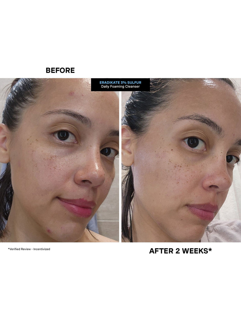 Kate Somerville EradiKate Daily Foaming Cleanser 120ml (British brand)