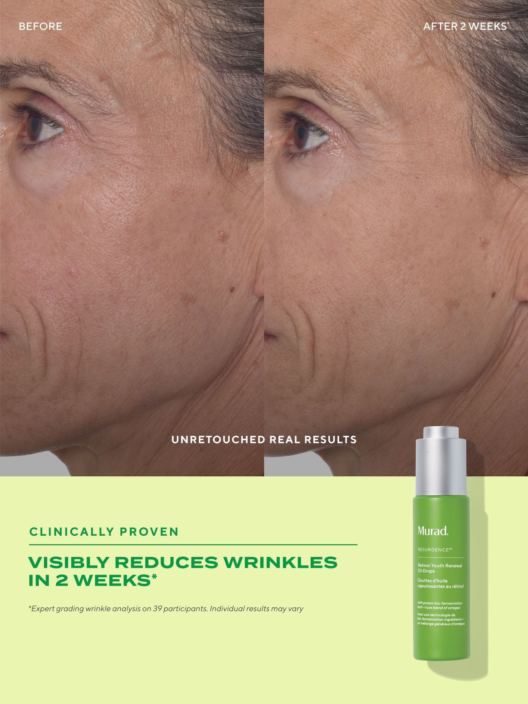 Murad Retinol Youth Renewal Oil Drops 30ml