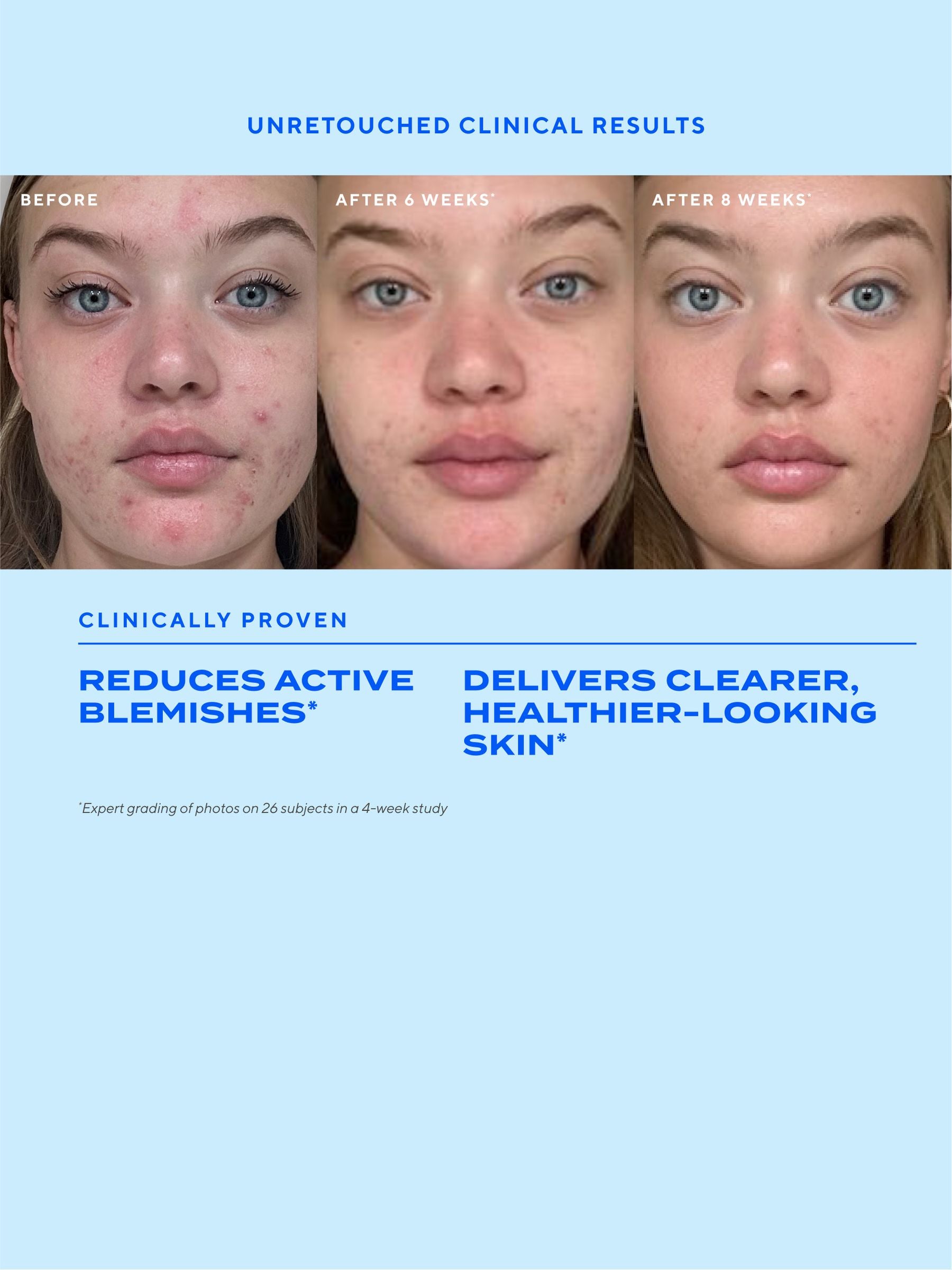 Murad Biome Balancing Clear Prevent Blemish Treatment Serum, imported from the UK