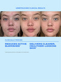 Murad Biome Balancing Clear Prevent Blemish Treatment Serum, imported from the UK
