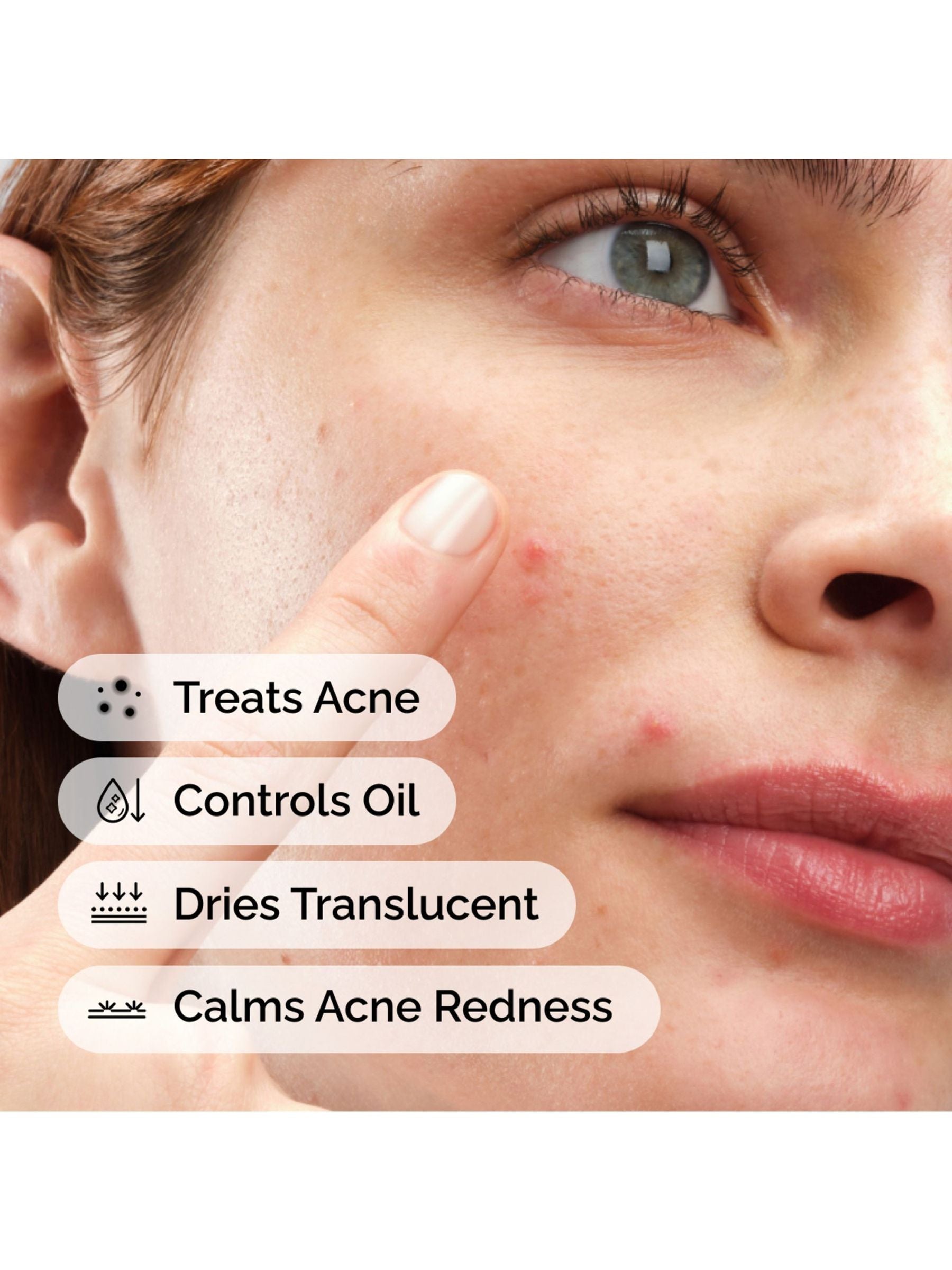 The Ordinary Sulfur 10% powder-to-cream concentrate 5g, imported from the UK