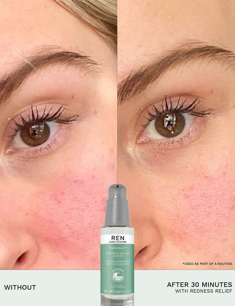 Evercalm™ Redness Relief Serum 30ml