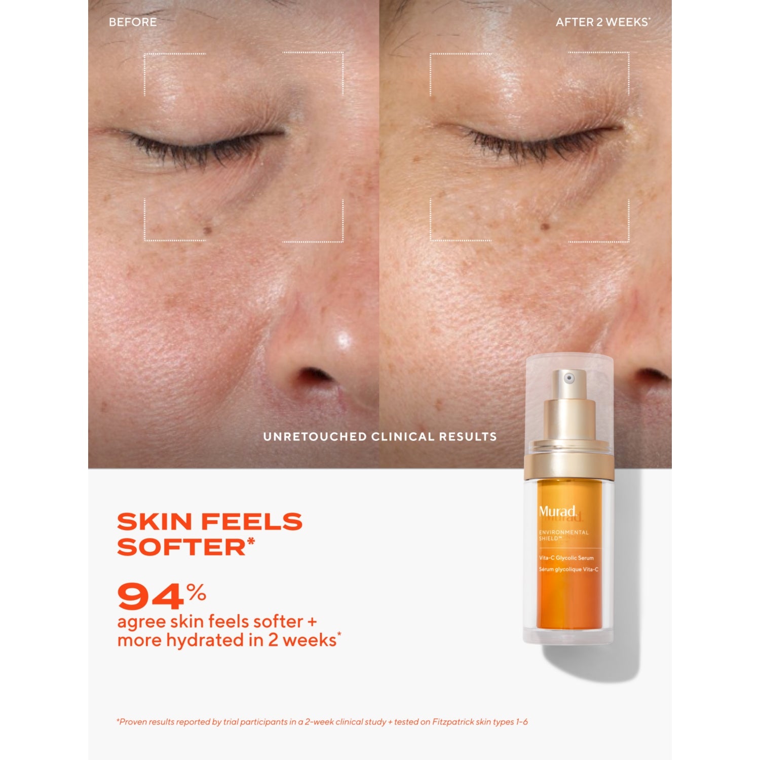 Murad Vita-C Glycolic brightening serum 30ml, imported from the UK
