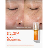 Murad Vita-C Glycolic brightening serum 30ml, imported from the UK