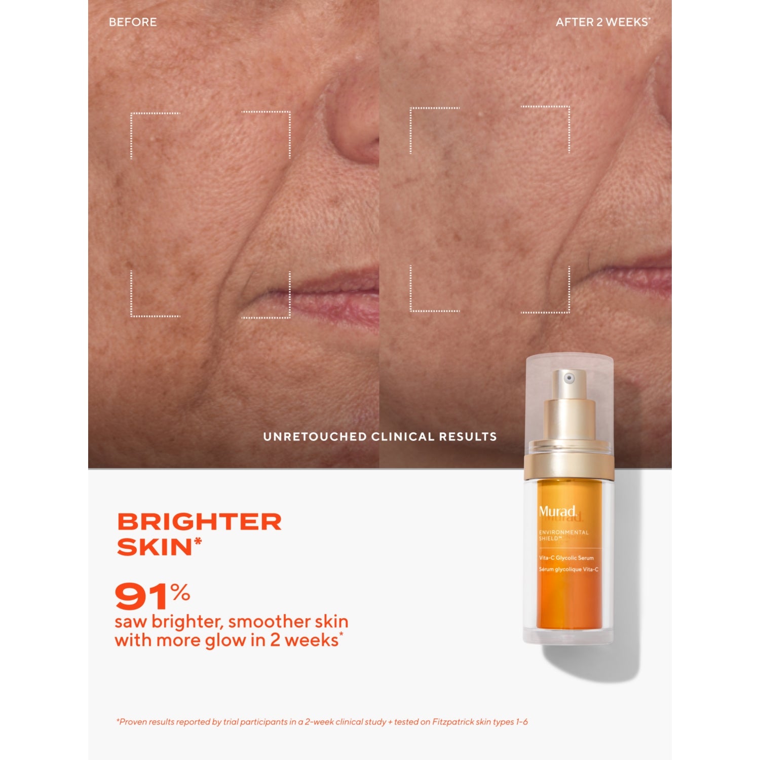 Murad Vita-C Glycolic brightening serum 30ml, imported from the UK