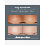 Dermalogica Daily Microfoliant exfoliating powder refill 74g, UK version