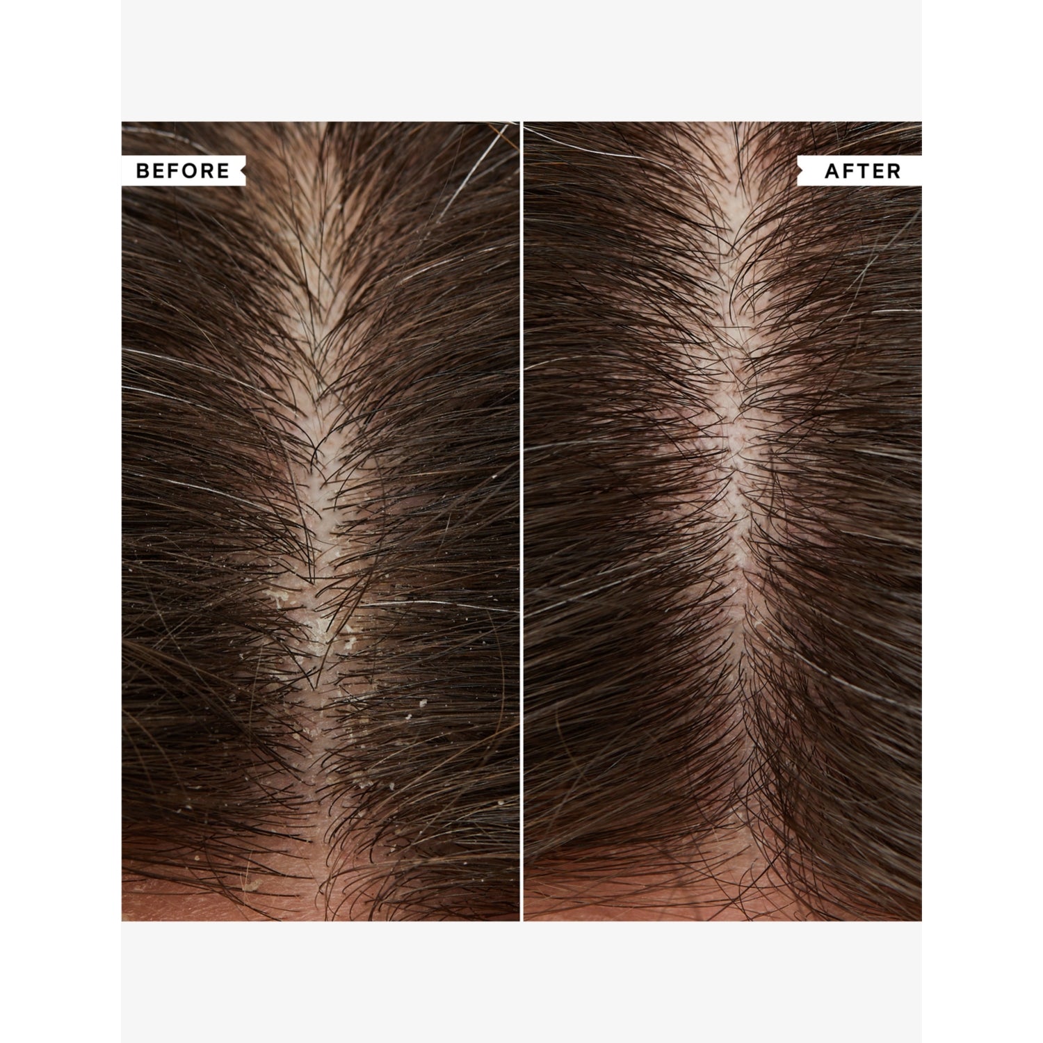 Philip Kingsley hydrating conditioner for flaky itchy scalp 75ml (British brand)