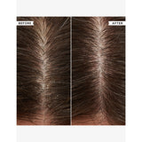 Philip Kingsley hydrating conditioner for flaky itchy scalp 75ml (British brand)