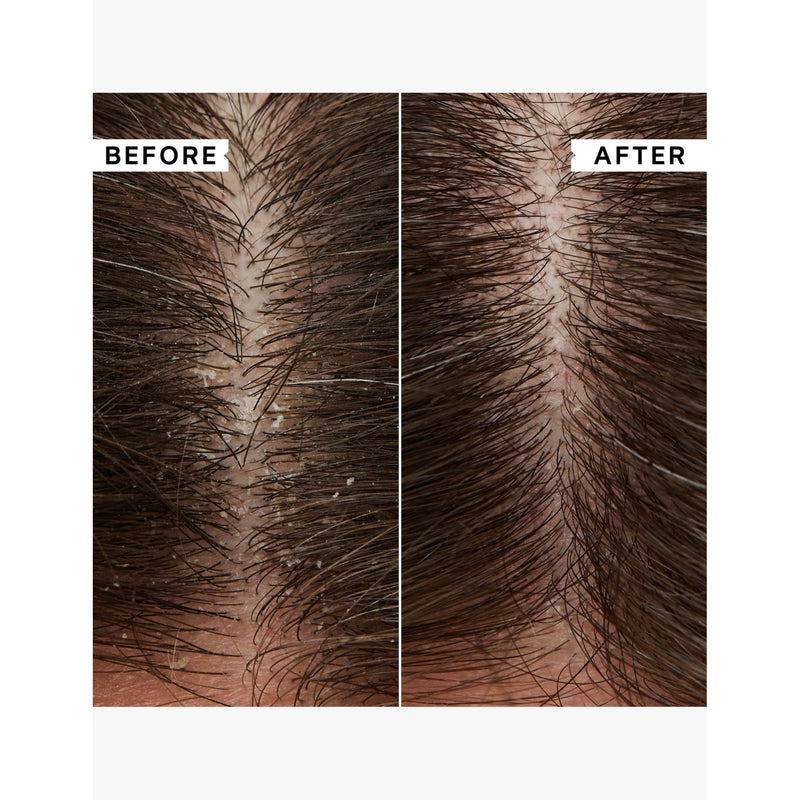 Philip Kingsley flaky itchy scalp hydrating conditioner 200ml, UK version